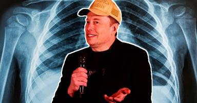 Elon Musk Recommends Feeding Your Medical Scans Into His Grok AI